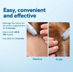 Hair BallEssence Be-Bodywise Rosemary Hair Growth