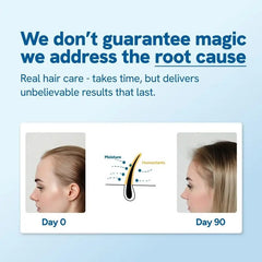 Hair BallEssence Be-Bodywise Rosemary Hair Growth