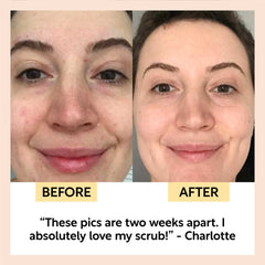 Travel-Size Skincare Bundle
