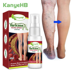KanyeHB Vein Spray for Leg Care - 30ml